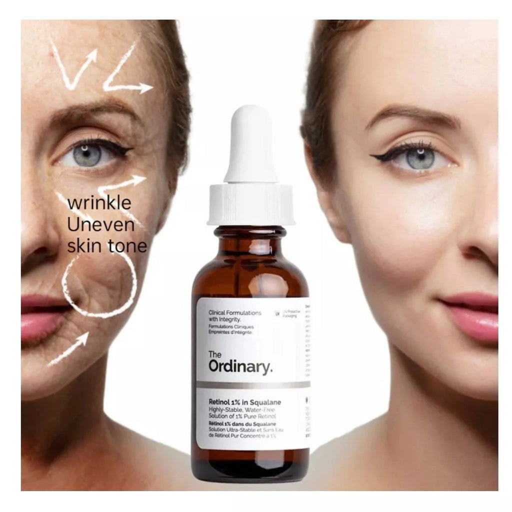 Retinol 1% In Squalane Serum The Ordinary