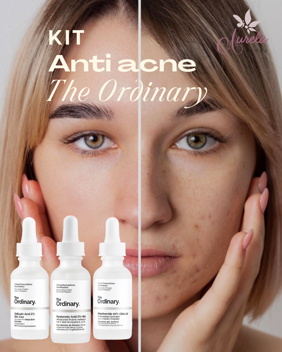 KIT Anti Acné The Urinary